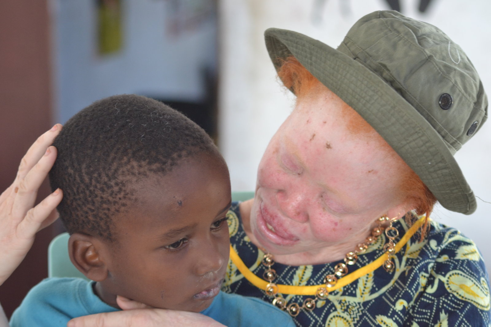 Foto Albino With Her Child Sabrina Avakian
